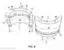 Fig. 07 - Stuffing box body with integral diverted lantern ring