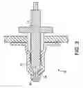 Fig. 04 - BOLT RETENTION SYSTEM