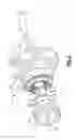 Fig. 03 - Bevel facespline with line contact