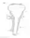 Fig. 05 - Chain tensioner