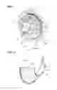 Fig. 03 - Baffle plate for differential device