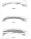 Fig. 06 - Gap-Sub and Measurement While Drilling Assemblies Using Kerros Ringed Gasket Spacers
