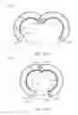Fig. 17 - Face-to-face positive restrained rotating pipe flange