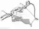 Fig. 01 - Lighting device and method of using the same
