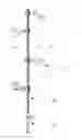 Fig. 01 - Outdoor lighting system and spike light for the same