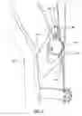 Fig. 04 - Archery bow brake