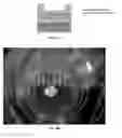 Fig. 03 - Engineered renal tissues, arrays thereof, and methods of making the same