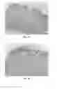 Fig. 04 - Engineered renal tissues, arrays thereof, and methods of making the same