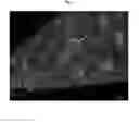 Fig. 05 - Engineered renal tissues, arrays thereof, and methods of making the same