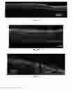 Fig. 10 - Engineered renal tissues, arrays thereof, and methods of making the same