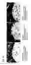 Fig. 20 - Antibody-nanoparticle conjugates and methods for making and using such conjugates
