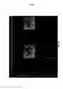Fig. 11 - 3-D in vitro model for breast cancer dormancy