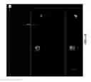 Fig. 14 - 3-D in vitro model for breast cancer dormancy