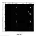 Fig. 31 - 3-D in vitro model for breast cancer dormancy