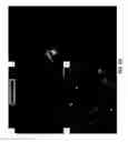 Fig. 40 - 3-D in vitro model for breast cancer dormancy