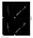 Fig. 41 - 3-D in vitro model for breast cancer dormancy