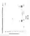 Fig. 60 - 3-D in vitro model for breast cancer dormancy