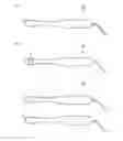 Fig. 01 - Data acquisition method for determining likelihood that ovarian endometriotic cyst is cancerous, and diagnostic device for same