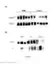 Fig. 02 - METHODS OF DETECTING AND TREATING PULMONARY HYPERTENSION