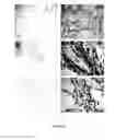 Fig. 06 - METHODS OF DETECTING AND TREATING PULMONARY HYPERTENSION