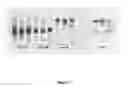 Fig. 03 - ASSAY FOR DETERMINATION OF LEVELS OF LIPOPROTEIN PARTICLES IN BODILY FLUIDS