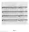Fig. 04 - ASSAY FOR DETERMINATION OF LEVELS OF LIPOPROTEIN PARTICLES IN BODILY FLUIDS