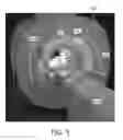 Fig. 04 - Bore region lighting unit for magnetic resonance scanner