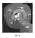 Fig. 05 - Bore region lighting unit for magnetic resonance scanner
