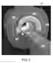 Fig. 06 - Bore region lighting unit for magnetic resonance scanner