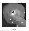 Fig. 07 - Bore region lighting unit for magnetic resonance scanner