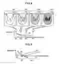 Fig. 04 - Magnetic resonance imaging apparatus and image generation method