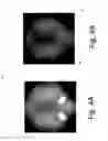 Fig. 05 - Illumination field diaphragms for use in microscopes and related methods and systems