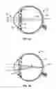 Fig. 02 - Limited echellette lens, systems and methods