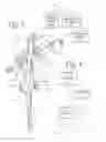 Fig. 04 - Security system for wrist watches