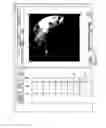 Fig. 16 - METHODS, SYSTEMS AND DEVICES FOR SPINAL SURGERY POSITION OPTIMIZATION