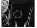 Fig. 01 - Cutting three-dimensional image