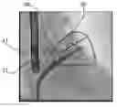 Fig. 01 - Medical viewing system with a viewing plane determination