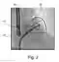 Fig. 03 - Medical viewing system with a viewing plane determination