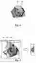 Fig. 05 - Medical viewing system with a viewing plane determination