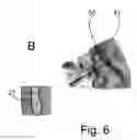 Fig. 06 - Medical viewing system with a viewing plane determination