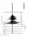 Fig. 11 - Low-complexity voice activity detection