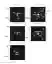 Fig. 08 - Electron microscope and sample observation method