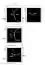 Fig. 09 - Electron microscope and sample observation method