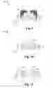 Fig. 06 - Nitride-free spacer or oxide spacer for embedded flash memory