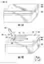 Fig. 02 - Laser processing of superconductor layers