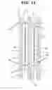 Fig. 11 - Pressurization device for battery cells