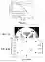 Fig. 15 - LATERAL ELECTROCHEMICAL ETCHING OF III-NITRIDE MATERIALS FOR MICROFABRICATION