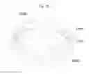 Fig. 11 - Electric machine