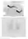 Fig. 06 - Electromagnetic device