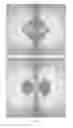 Fig. 76 - Electromagnetic device